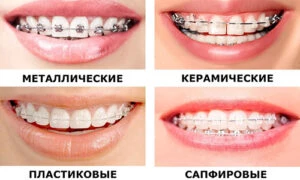 64ff020679c59.webp