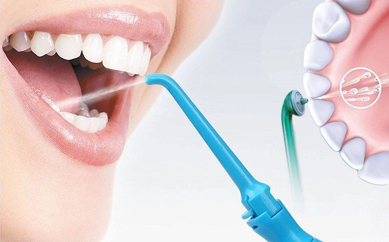 стоматологічна клініка, Києв, чистка, лікування зубів