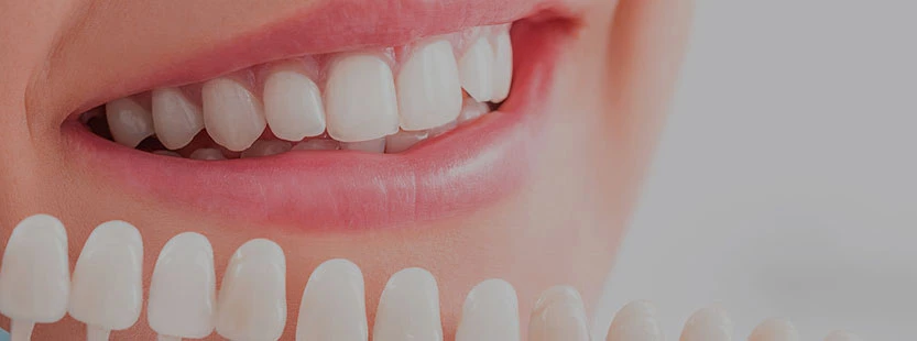улучшение цвета зубов