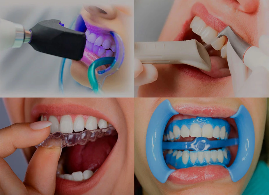 Профессиональное отбеливание зубов у стоматолога