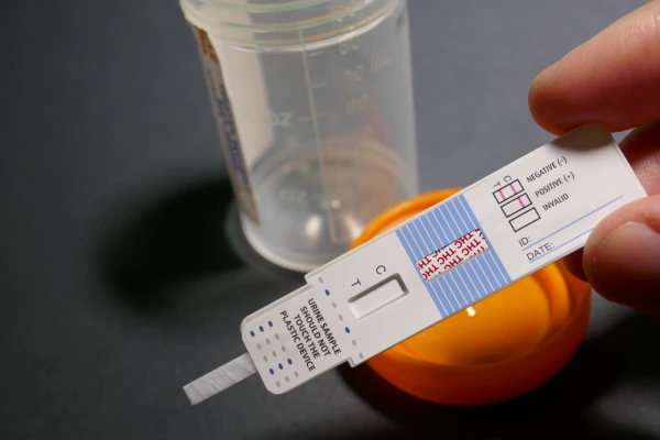 urine drug test