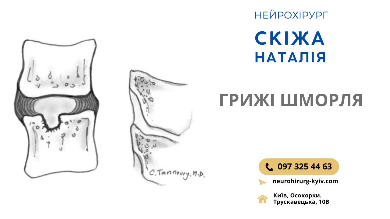6828bea59d953.webp