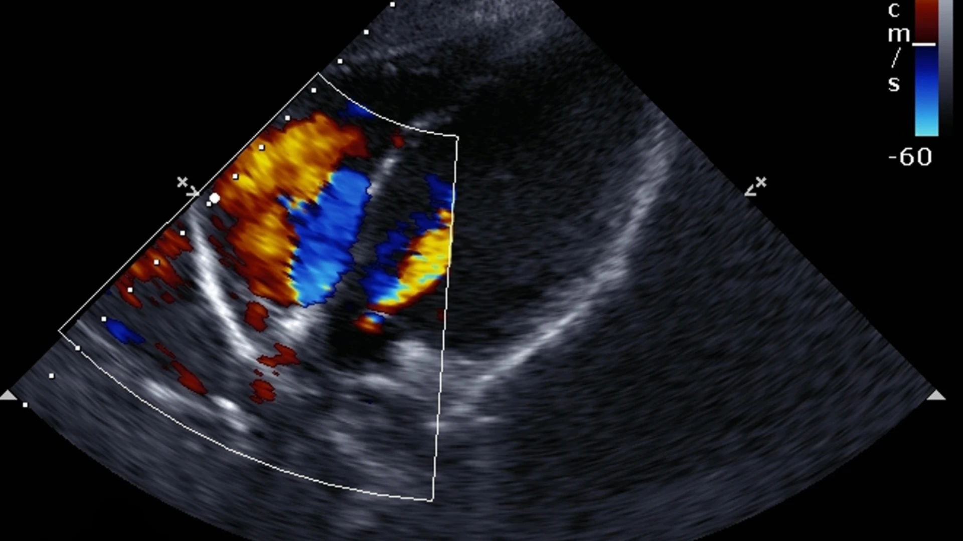 УЗД серця у Львові