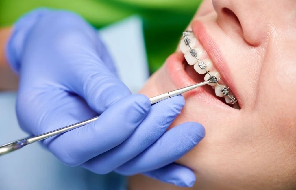 прийом у ортодонта