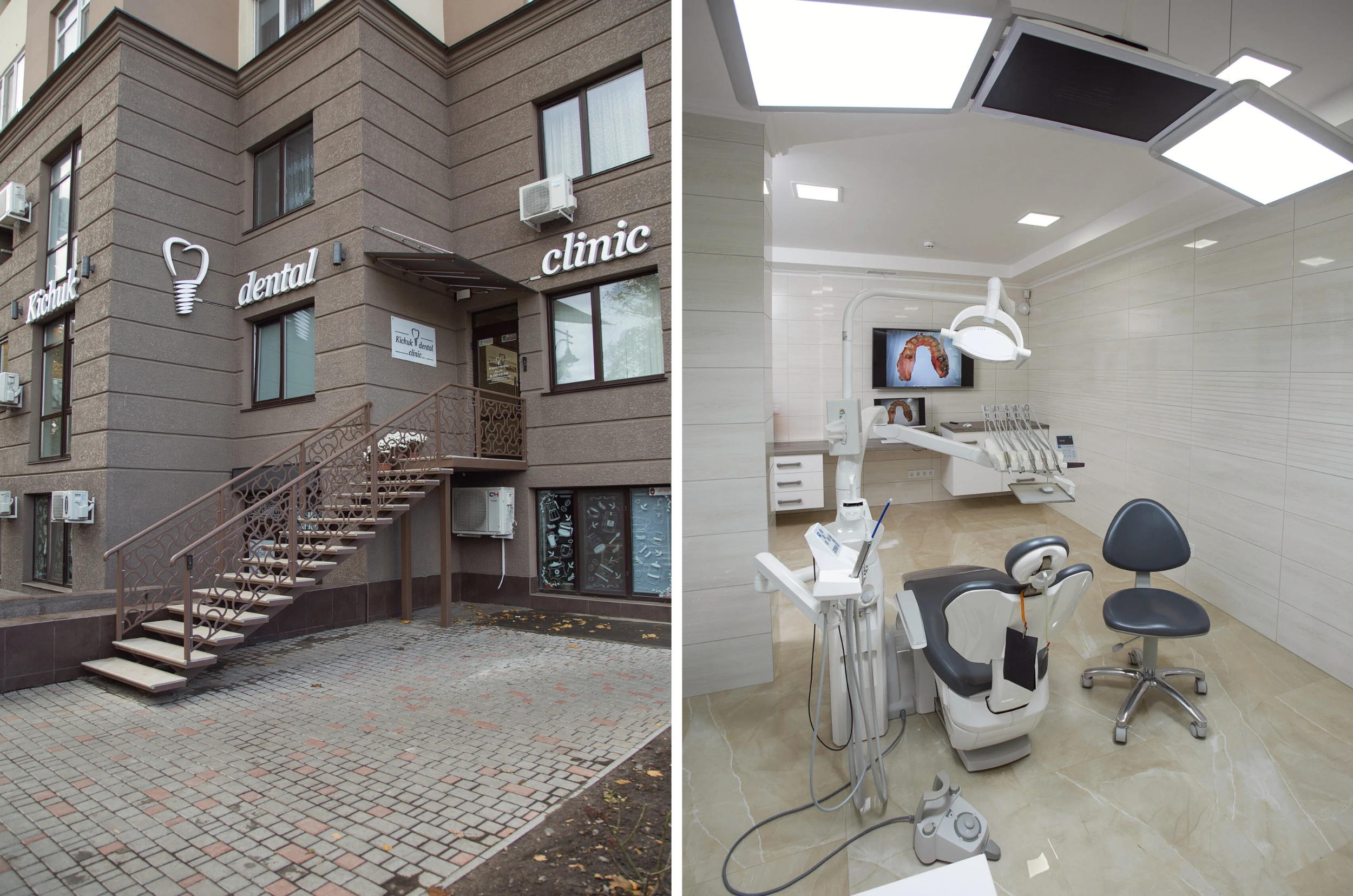 Современная стоматология «Kichuk Dental Clinic» в Одессе на слободке