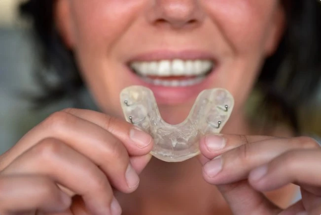 первые шаги после установки элайнеров