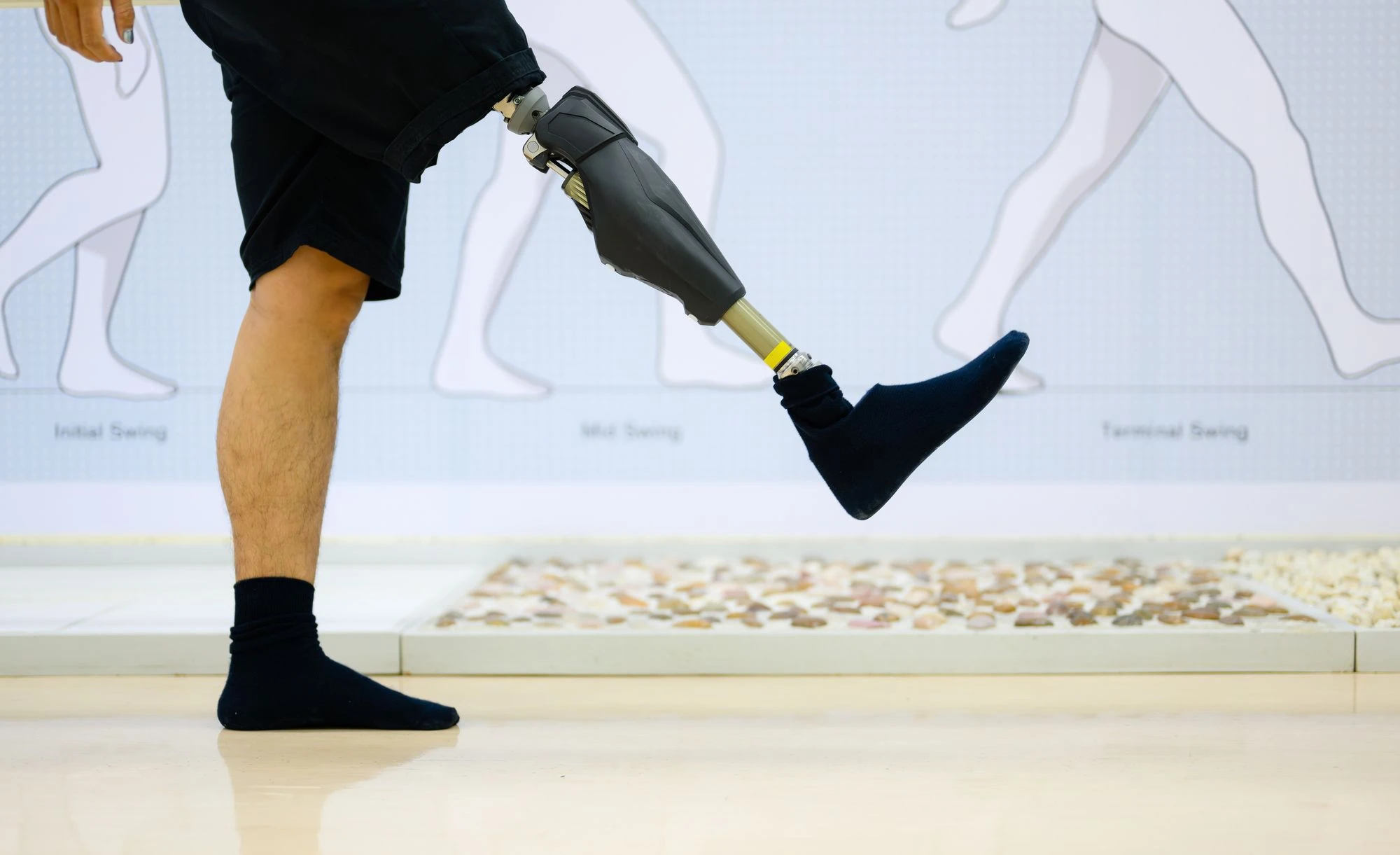 Як часто треба корегувати посадку протеза?