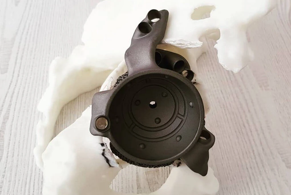 Гільза культеприймача у сучасних протезах