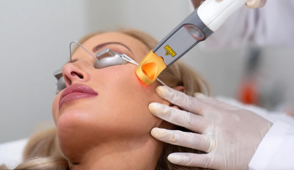 Лікування судин на обличчі лазером