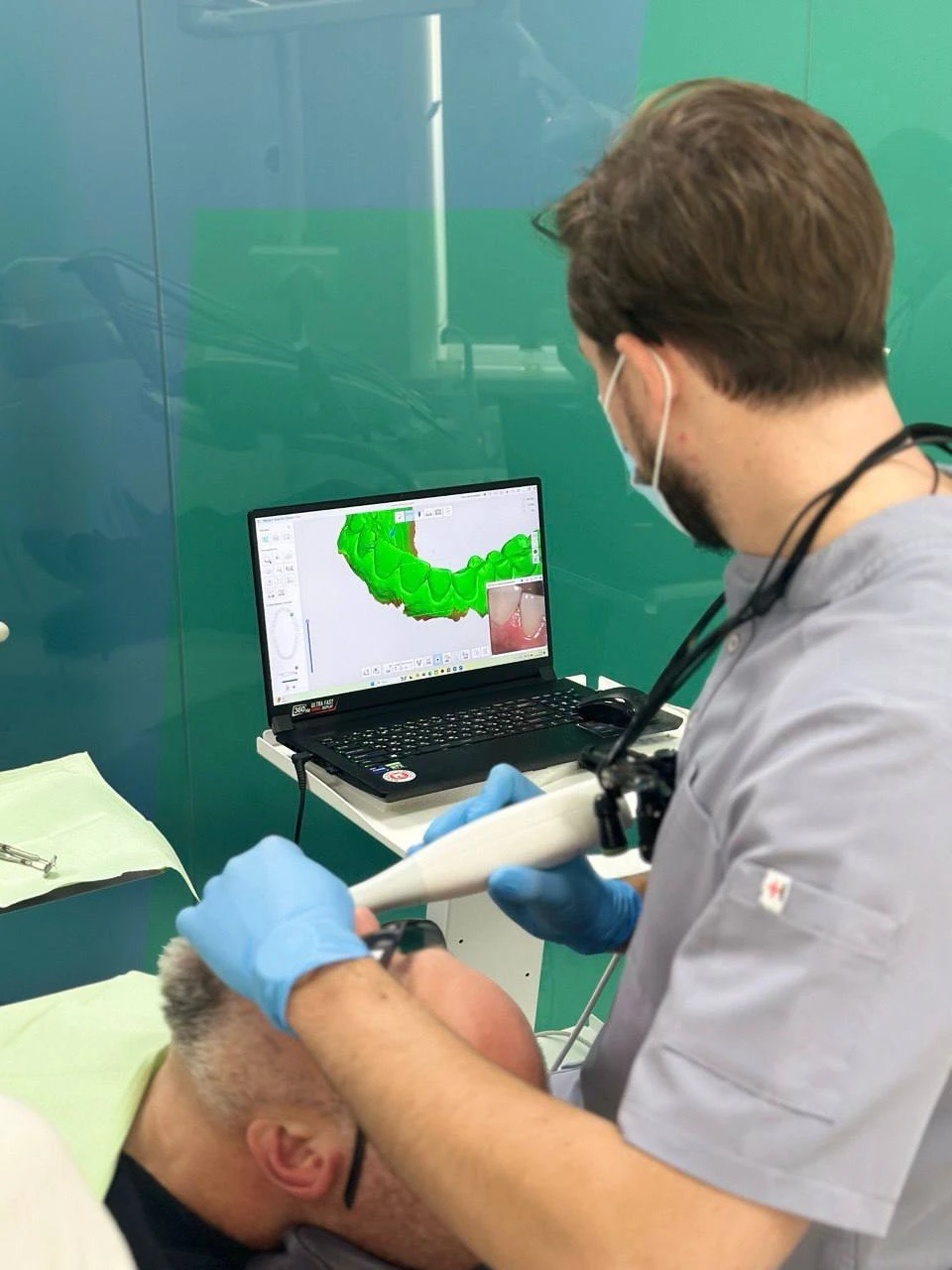 3D-сканування зубів: як цифрова технологія змінила стоматологію - фото