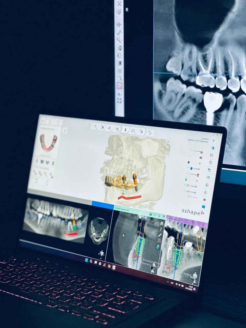 3D-сканування зубів: як цифрова технологія змінила стоматологію - фото