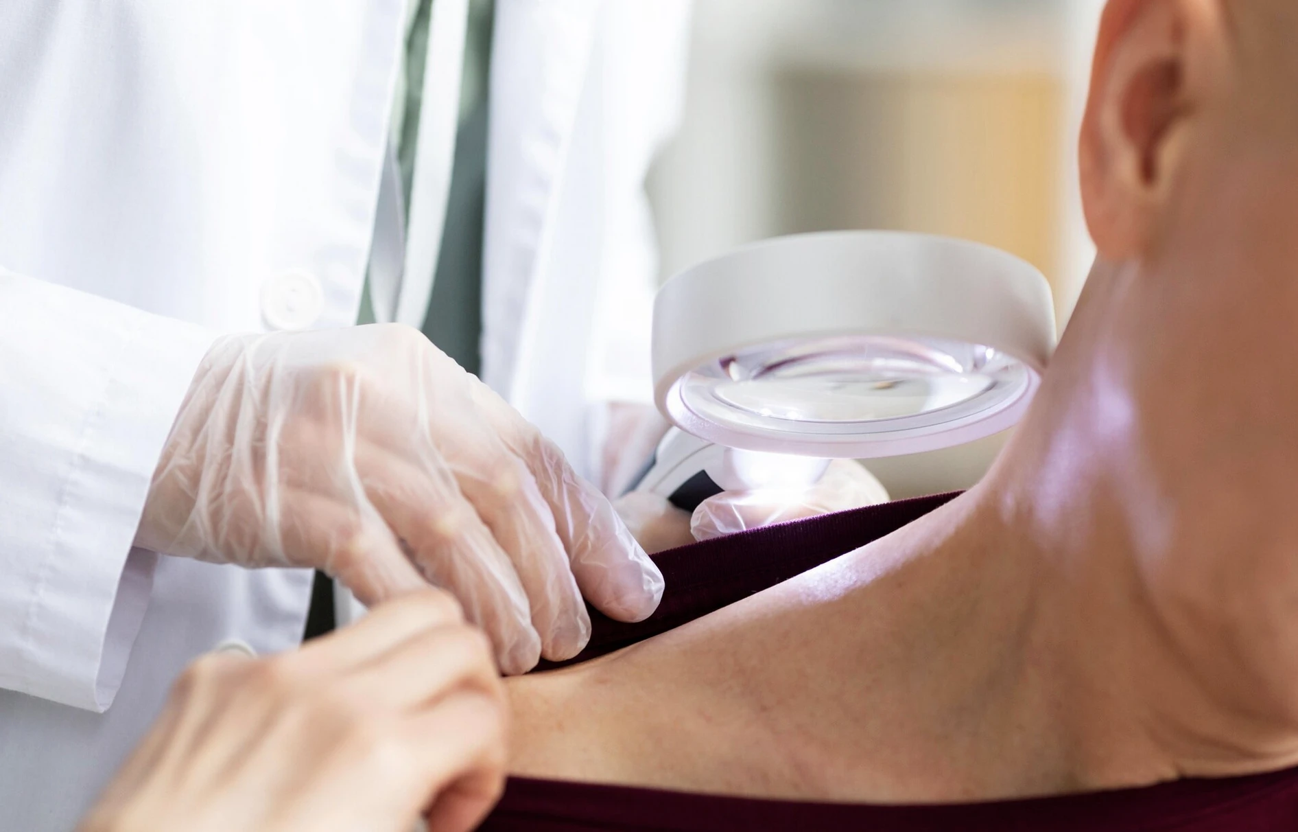 Родимка змінилася: у яких випадках це небезпечно