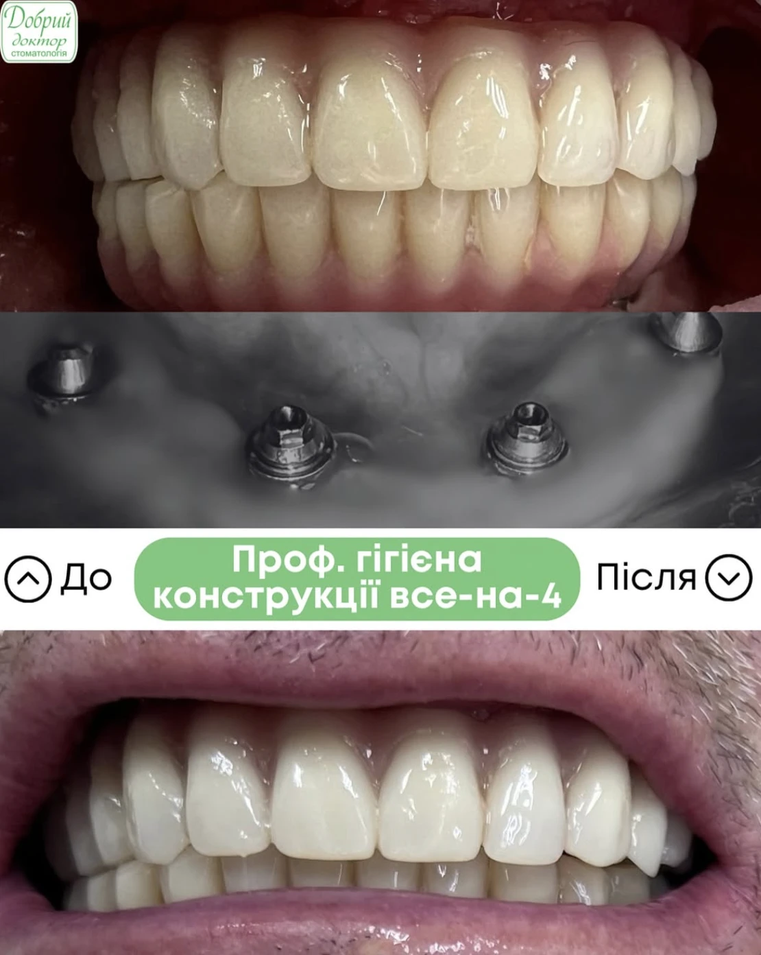 69cb931f95c85.webp