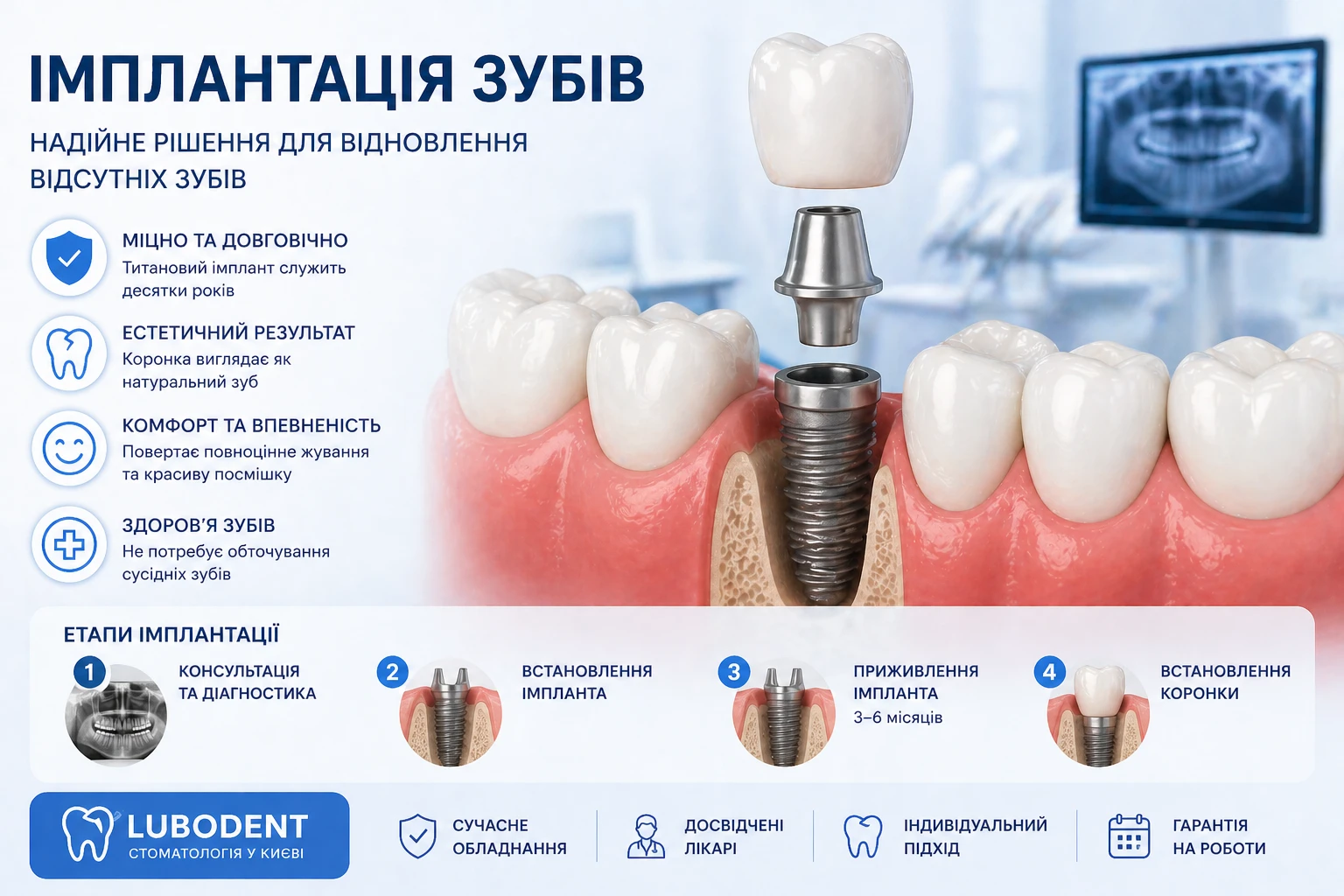 імплантація зубів Київ встановлення імпланта стоматологія Lubodent