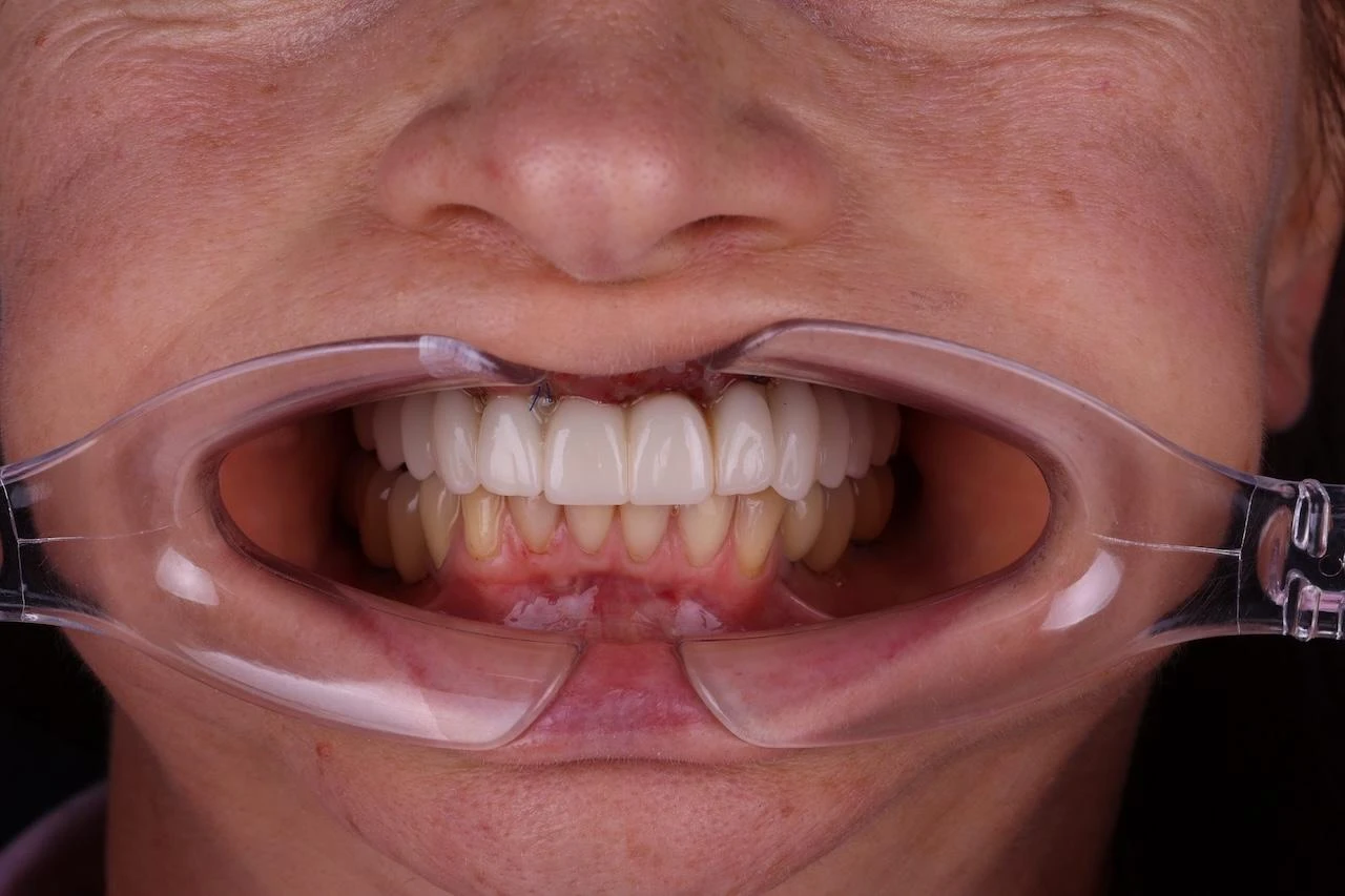6a09e908496e1.webp