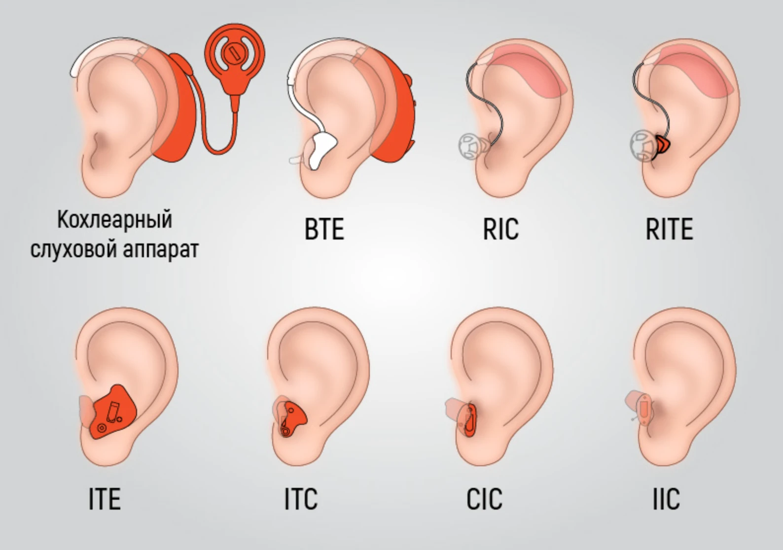 усі види слухових апаратів