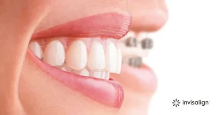 6a4e70191ef0e.webp