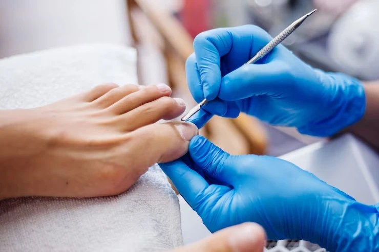 Medi-pedicure stóp
